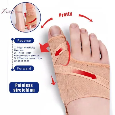 Cappuvini 1 Cặp Dụng Cụ Tách Ngón Chân Lớn Bunion Corrector Hallux Valgus Chỉnh Sửa Thiết Bị Xương Ngón Tay Cái Chỉnh Hình Bàn Chân Trước Miếng Lót Chân Thẳng Đẹp