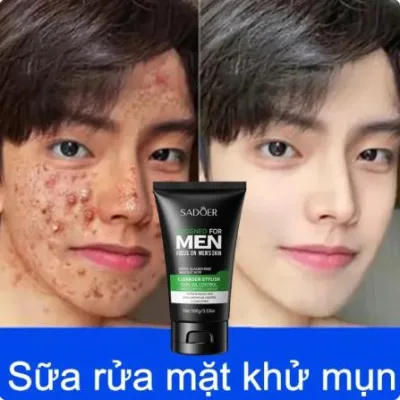 Sữa rửa mặt làm trắng da mặt Chăm sóc da mặt mụn cho nam giới làm sạch sâu Làm Trắng Da,Dưỡng Ẩm