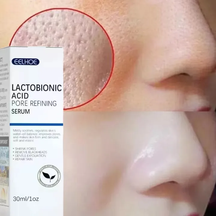 Pores serum Thu Nhỏ Lỗ Chân Lông Úc Tinh Chất Dưỡng Ẩm Dầu Cây Trà Tinh Chất Thu Nhỏ Lỗ Chân Lông Mặt Tinh Chất Se Khít Lỗ Chân Lông Chăm Sóc Da