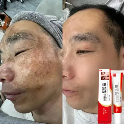 Kem IMAGES Làm Trắng Tàn Nhang Loại Bỏ Mạnh Mẽ Nám Melanin Vết Thâm Nám Đốm Đen Đồi Mồi Làm Sáng Màu Da Dưỡng Ẩm Chăm Sóc Da Hiệu Quả Trong 7 Ngày 20g