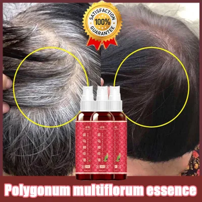 Xịt dưỡng tóc đen Shouwu dầu gội thảo dược đen tự nhiên Shouwu bóng mượt sức sống truyền dưỡng chất đen bóng ngăn ngừa rụng tóc chăm sóc cá nhân 100ml