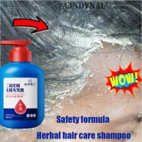 Dầu gội trị gàu Selenium disulfide 300ML ngứa nhanh kháng khuẩn phục hồi viêm da giúp gàu rụng tự nhiên chăm sóc cá nhân