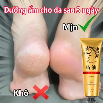 Kem nứt gót chân kem bôi nứt gót chân Kem Dưỡng Ẩm Chống Nứt Nẻ Gót Chân Loại bỏ da chết, chăm sóc gót chân