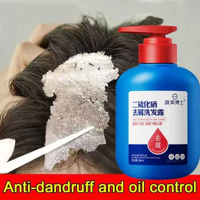 Dầu gội trị nấm trị gàu 300ml dầu gội trị gàu selen disulfide chống ngứa kiểm soát dầu phục hồi da bị viêm da nhẹ không gây tổn thương da chăm sóc cá nhân