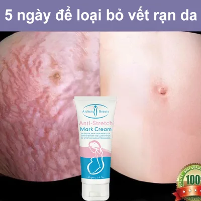 Kem sửa chữa vết rạn da 60g Chăm sóc đặc biệt sau sinh, Loại bỏ sẹo khi mang thai, Làm săn chắc vết thương Phục hồi vết sẹo Sửa chữa vết thương, Xóa sẹo vĩnh viễn