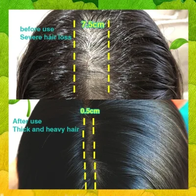 Dầu chăm sóc tóc, giúp tóc mịn, khô chất lỏng dinh dưỡng cho tóc, bôi trơn tóc, giúp tóc phát triển