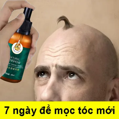 Tinh chất tăng trưởng tóc Tinh dầu tăng trưởng tóc Ngăn ngừa rụng tóc nuôi dưỡng và chăm sóc tóc thúc đẩy tăng trưởng tóc Tinh chất ngăn ngừa rụng tóc cho nam và nữ 30ML