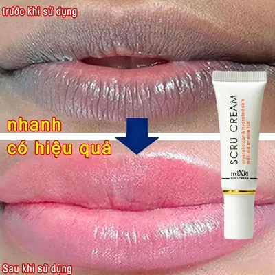 High Quality Effective Lip Exfoliating Gel for Lip Skin Care Exfoliates Dead Skin Cells, Nourishes Lips and Moisturizes to Prevent Dryness