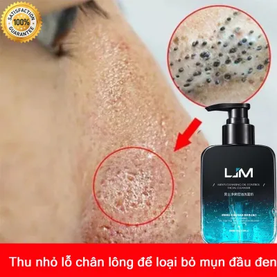 Thu nhỏ lỗ chân lông làm sạch Sữa rửa mặt khử mụn 150G nhanh chóng thu nhỏ lỗ chân lông dưỡng ẩm da loại bỏ mụn trứng cá mụn trứng cá Vaccinia nhẹ nhàng làm sạch chăm sóc cá nhân