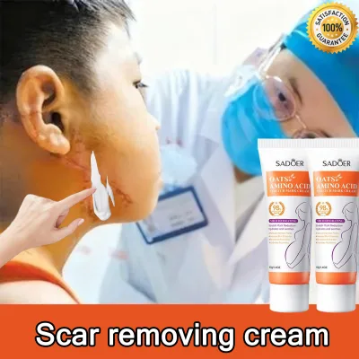 Kem xóa sẹo vĩnh viễn ức chế tăng sinh sẹo dưỡng ẩm và làm mềm thúc đẩy phục hồi da làm mờ sẹo dịu nhẹ và không gây kích ứng chăm sóc cá nhân 40g