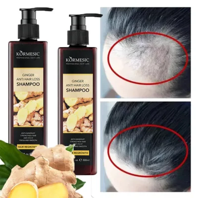 Shampoo to Prevent Hair Loss Extracted from Fresh Ginger 300ml Cares for Thin Hair, Stimulates Hair Growth and Prevents Hair Loss. Ginger Shampoo Restores Damage to Hair, Making It Thick, Soft, and Smooth. Hair Growth Liquid.