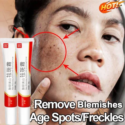 Kem dưỡng trắng da chống tàn nhang dưỡng ẩm kem trị nám 20g cải thiện sắc tố da xỉn màu phục hồi các vết thâm nuôi dưỡng làn da chăm sóc cá nhân