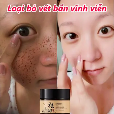 Kem Xóa Mờ Tàn Nhang Làm Trắng Hiệu Quả,Kem xóa tàn nhang tinh chất chất làm trắng da mặt và loại bỏ nám làm sáng da chăm sóc kem nám