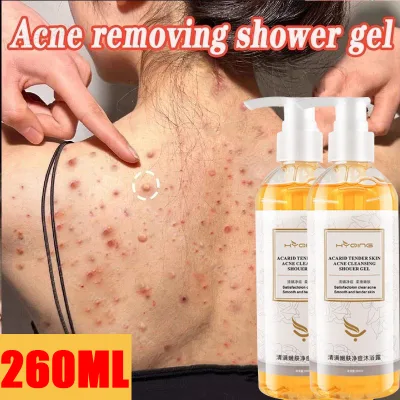 Sữa tắm làm dịu da trị mụn làm trắng da 500ml loại bỏ mạt bụi phục hồi mụn vết thâm do mụn làm sạch nhẹ nhàng chăm sóc cá nhân