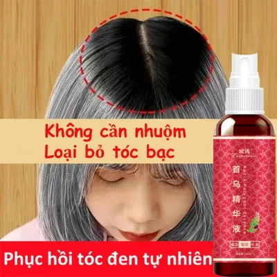 Hair Care Essence Black Hair Essence Hair Growth Spray Natural Plant Extracts Are Effective for Black Hair Hair Growth 100ml