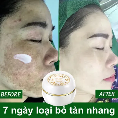 kem tàn nhang làm trắng Loại bỏ nám Làm sáng các đốm Loại bỏ sự xỉn màu trên khuôn mặt Kiểm soát dầu dưỡng ẩm,loại bỏ đốm đen làm trắng kem chống nắng Chăm sóc Da trắng sáng Tự nhiên 30g