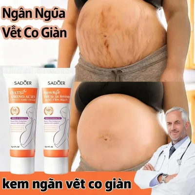 Postpartum Stretch Mark Removal Cream Fades Dark Spots, Brightens and Evens Skin Tone, Improves Skin Tone, Helps Skin Become Evenly Bright, Cares for Firm Skin 40g