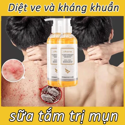 Sữa tắm trị mụn kháng khuẩn 500ml Sữa tắm trị mụn kháng nấm và ngứa làm sạch nhanh chóng và nhẹ nhàng làm dịu da và phục hồi làn da chăm sóc cá nhân