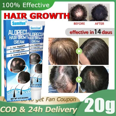 Hair Growth Fresh Cream Stimulates Hair Growth, Reduces Breakage and Loss, Helps Strengthen Hair after Scalp Care Alopecia Hair Growth Cream