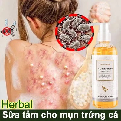 Sữa Tắm Hết Mụn Hết Viên Da Lưng Cánh Tay Cơ Thể Làm Trắng Mịn Da Dưỡng Ẩm Chăm Sóc Phục Hồi Da,Sáng Mịn Màng Cấp Ẩm Tái Tạo Da loại bỏ Mụn Lưng Siêu Tốt loại bỏ mạt và mụn trứng cá giảm ngứa khô sửa 260ml