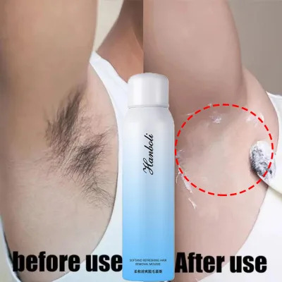 Tẩy lông vĩnh viễn phun kem tẩy lông 150ML Tẩy lông nhanh và nhẹ nhàng dưỡng ẩm cho da không đau Tẩy lông Chăm sóc cá nhân
