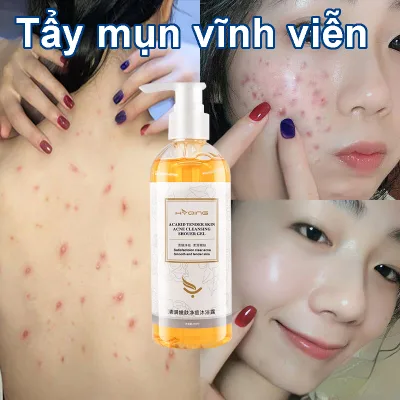 sữa tắm làm trắng, Sữa tắm loại bỏ mụn trứng cá, kháng khuẩn làm sạch sâu da thu nhỏ lỗ chân lông, Cơ Thể Làm Trắng Mịn Da Dưỡng Ẩm Chăm Sóc Phục Hồi Da