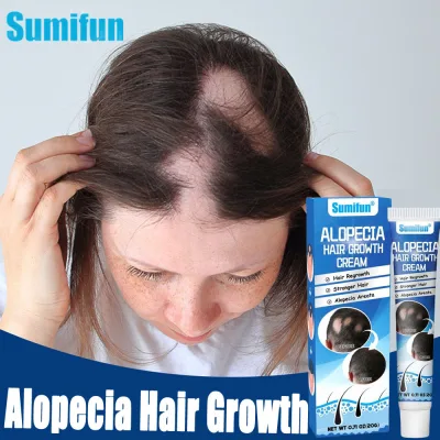 Alopecia Hair Growth Cream Scalp Care Hair Care Cream Helps Stimulate Growth, Reduce Breakage and Make Hair Fragrant Giot Lanh