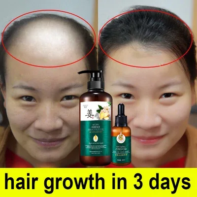 Dầu gội chống rụng tóc Gừng Nuôi dưỡng tóc Dầu gội tăng trưởng nhanh Dầu gội kiểm soát gàu Sửa chữa hư hỏng Dầu gội chăm sóc da đầu 500ml Dầu gội tái tạo tóc cho nam giới và phụ nữ