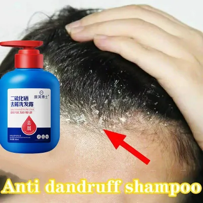 Dầu gội trị gàu chính hãng 100% dầu gội selenium disulfide chăm sóc tóc chống gàu chăm sóc da đầu dầu gội chống nấm dầu gội selenium disulfide 300ML