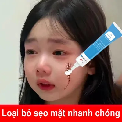 Kem xóa sẹo,Loại bỏ sẹo phẫu thuật 20g,Công thức loại bỏ sẹo nâng cao Sửa chữa Chăm sóc da Điều trị mụn Loại bỏ vết rạn da Kem dưỡng trắng da