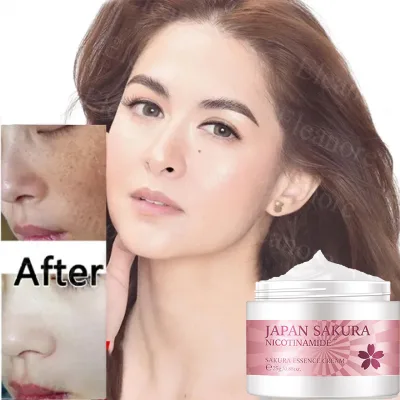 Kem xóa tàn nhang kem xóa nám 25g làm trắng da tinh chất chất làm trắng da mặt và loại bỏ nám làm sáng da chăm sóc,Kem Xoá Nám Tàn Nhang Giảm Thâm Nám Tàn Nhang Dưỡng Ẩm Trắng Da