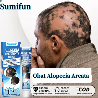 Alopecia Hair Growth Cream Rapid Hair Growth in Just a Few Days, Super Smooth Hair Growth, Scalp Care