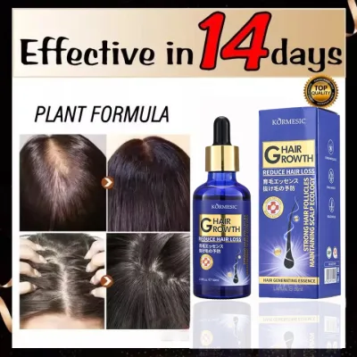 👍🏻 Genuine 👍🏻 Japan Hair Growth Essence Hair Growth Essential Oil 50ml Hair Growth Serum Hair Care Anti-Hair Loss, Stimulates Hair Growth Hair Growth