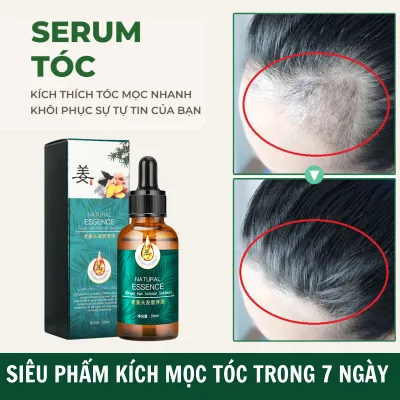 Tinh Dầu Mọc Tóc Ginger Hair Tăng Trưởng Tóc Tăng Cường Chân Tóc Để Ngăn Ngừa Rụng Tóc Nhanh Và Mạnh Mẽ Mọc Tóc Hư Tổn Mọc Râu Lông Mày Chiết Xuất Thảo Dược Thiên Nhiên Nguyên Bản Chăm Sóc, Nuôi Dưỡng Tóc 30Ml
