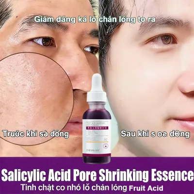 Serum to Shrink Pores, Acid, Moisturizing, Nourishing, Firming, Whitening, Anti-Aging, Anti-Wrinkle, Facial Care 30ml