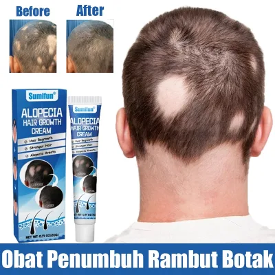 Alopecia Hair Growth Cream Hair Care Cream/Fast Hair Growth Stimulant (Rosemary Hair Cream)/ Scalp Care