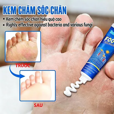 Pharmacy Fungus King Skin Premium Dermatological Cream Antibacterial Foot Care Anti-Itch Foaming 20g