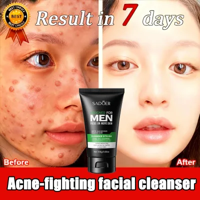 Salicylic Acne Facial Cleanser Oil Control Milk Reduces Redness Swelling Antibacterial Anti-Inflammatory Acne Repair Whitening Gentle Does Not Hurt Skin Personal Care 100g
